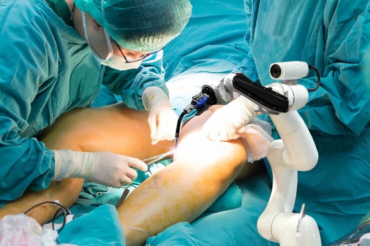 Robotic Total Knee Replacement in Bangalore
